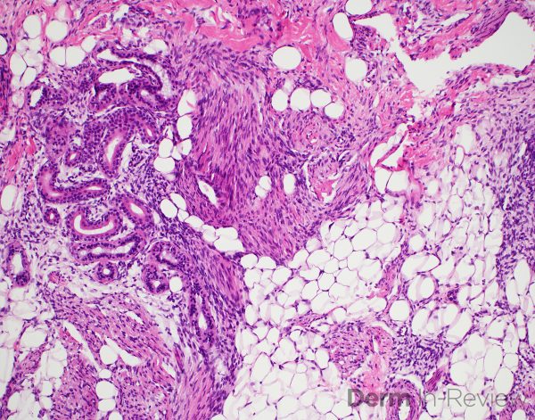 Figure 5.15.10 – Derm In-Review