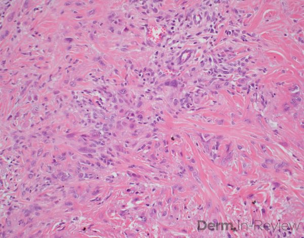 Figure 5.15.17A-B – Derm In-Review