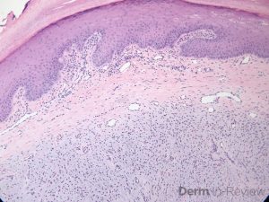 Figure 5.15.5 – Derm In-Review