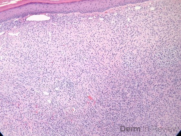 Figure 5.15.7 – Derm In-Review