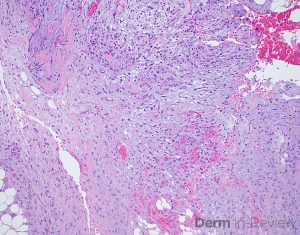 Figure 5.15.9 – Derm In-Review