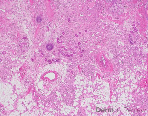 Figure 5.17.3 – Derm In-Review