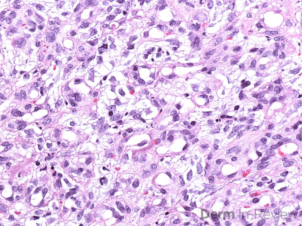 Figure 5.17.5 A-B – Derm In-Review