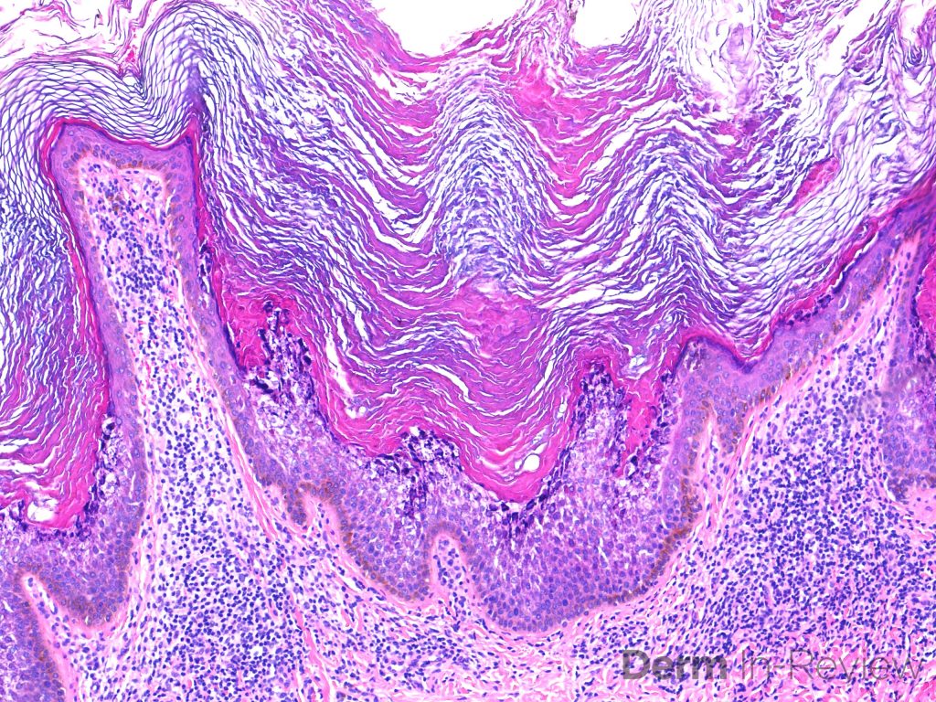 Figure 5.20.1 – Derm In-Review