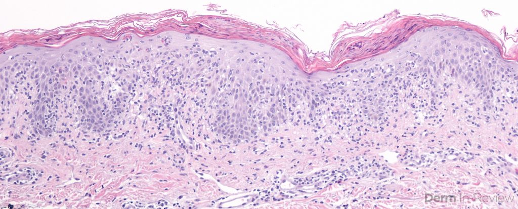 Figure 5.3.21 – Derm In-Review