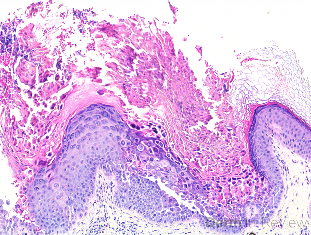 Figure 5.5.17 – Derm In-Review