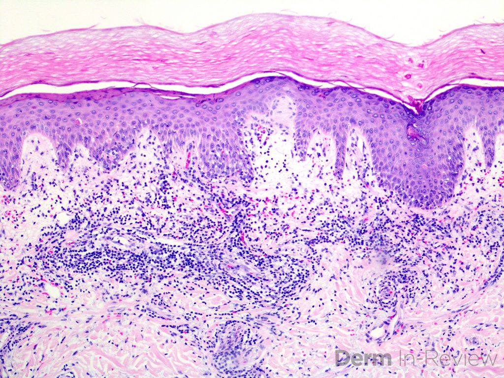 Figure 5.6.10 – Derm In-Review