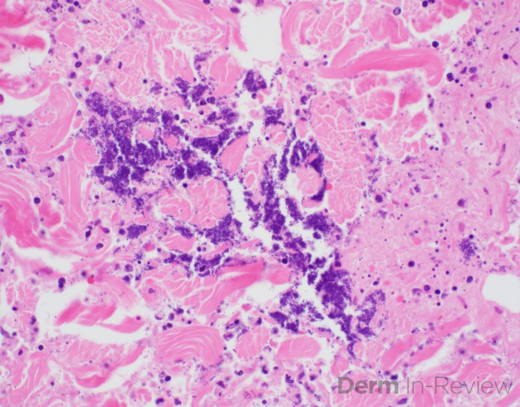 Figure 5.8.2 – Derm In-Review