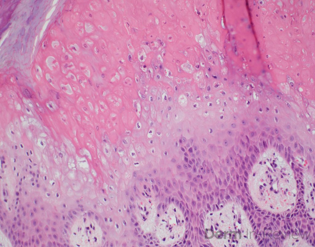 Figure 5.8.36A-B – Derm In-Review