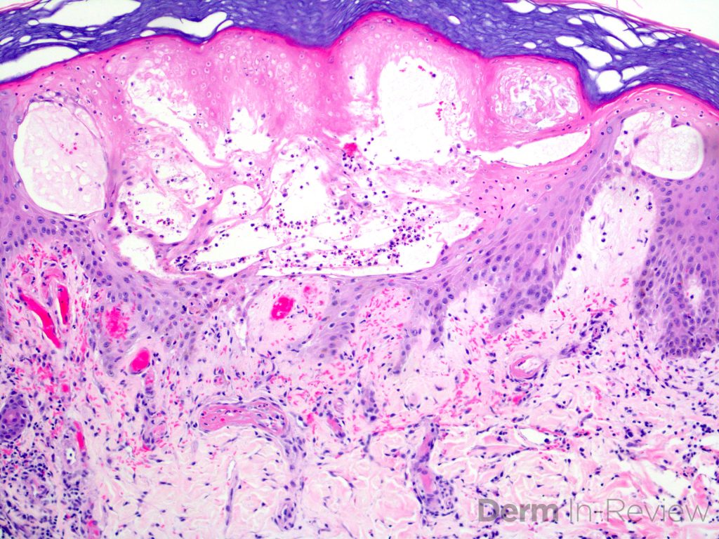 Figure 5.8.38 – Derm In-Review