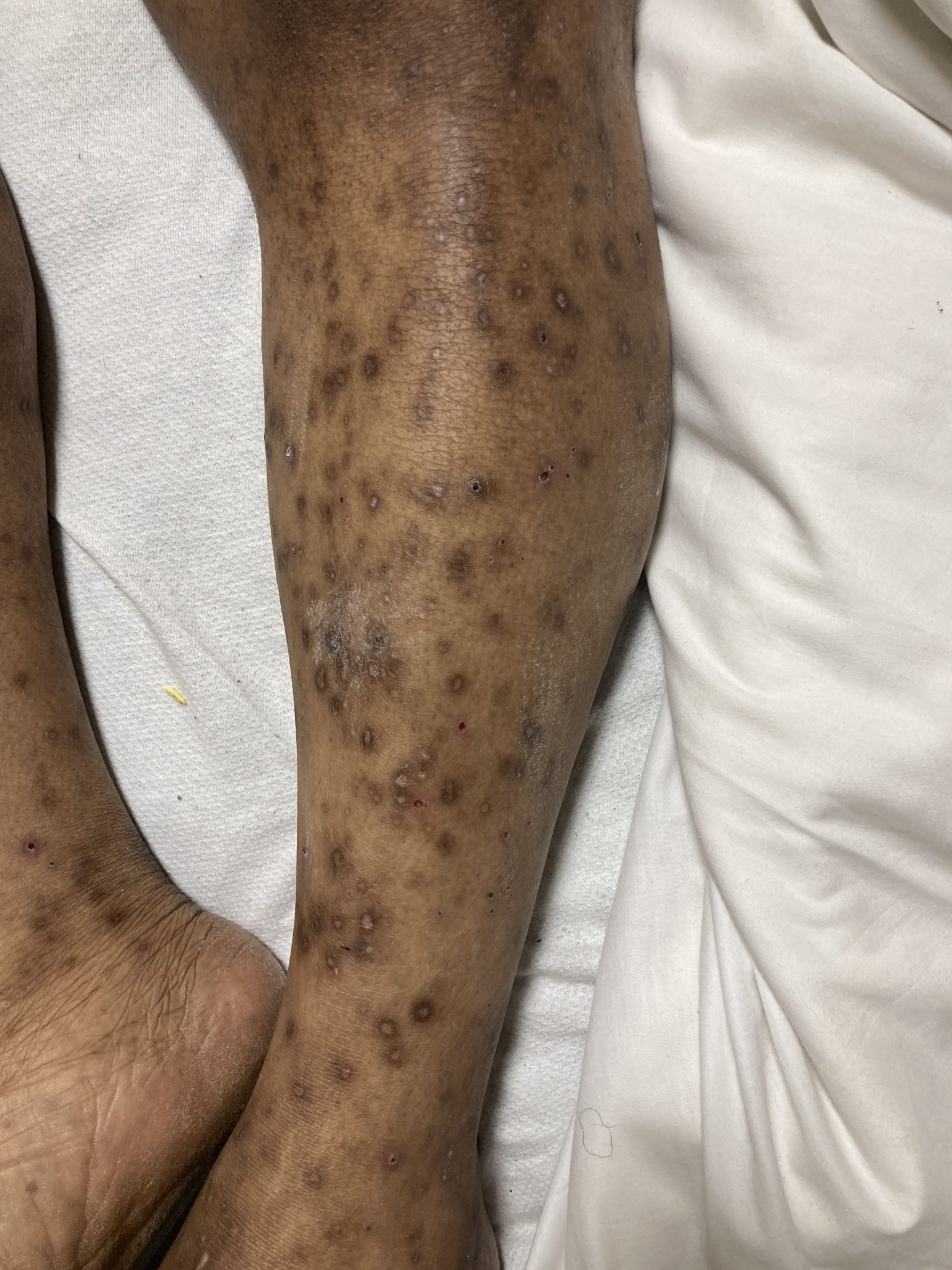 Fig 1B_clinical Derm InReview